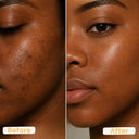 Hyperpigmentation Glow Face Wash